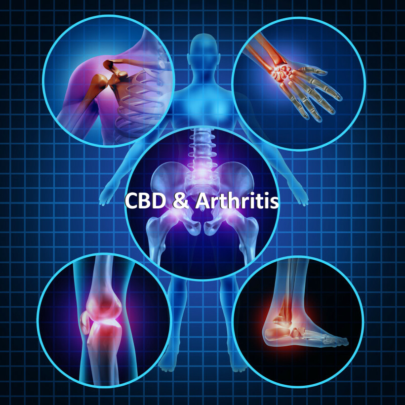 CBD & Arthritis