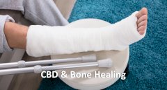 CBD & Bone Healing