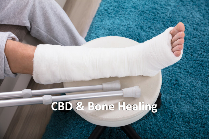 CBD & Bone Healing