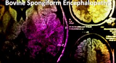 CBD & Bovine Spongiform Encephalopathy