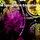 CBD & Bovine Spongiform Encephalopathy