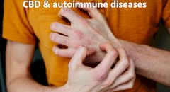 CBD and autoimmune diseases