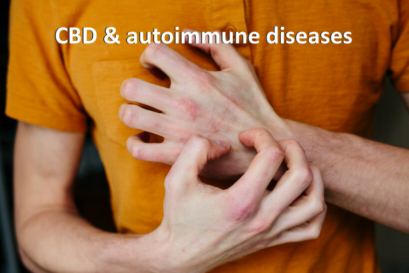 CBD & autoimmune diseases