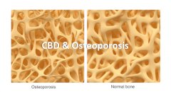 CBD and Osteoporosis