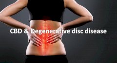 CBD and Degenerative disc disease