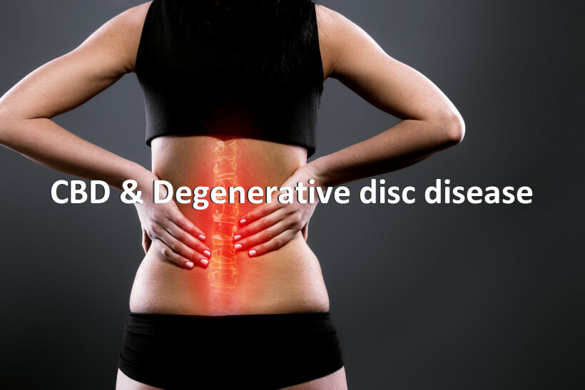CBD & Degenerative disc disease