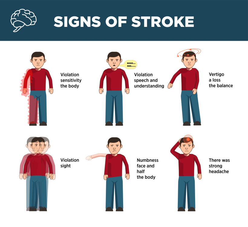 Signs of strokes