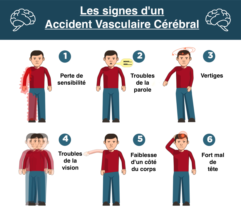 Les signes d'un AVC