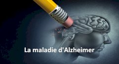 CBD & maladie d'Alzheimer