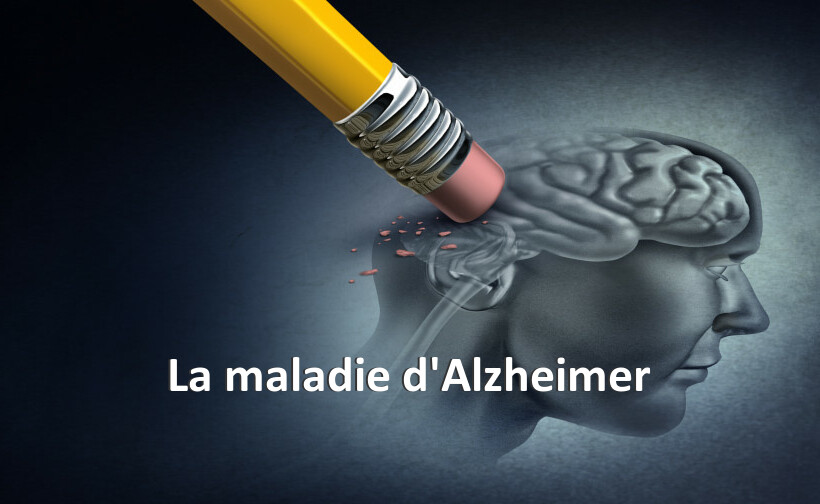 La maladie d'Alzheimer