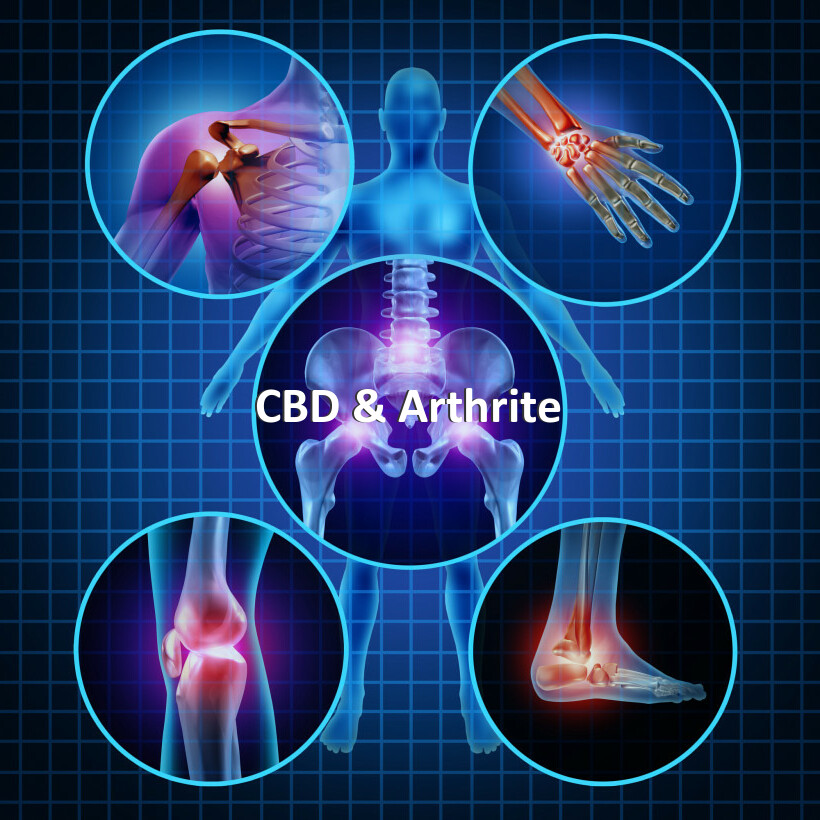 CBD & Arthrite