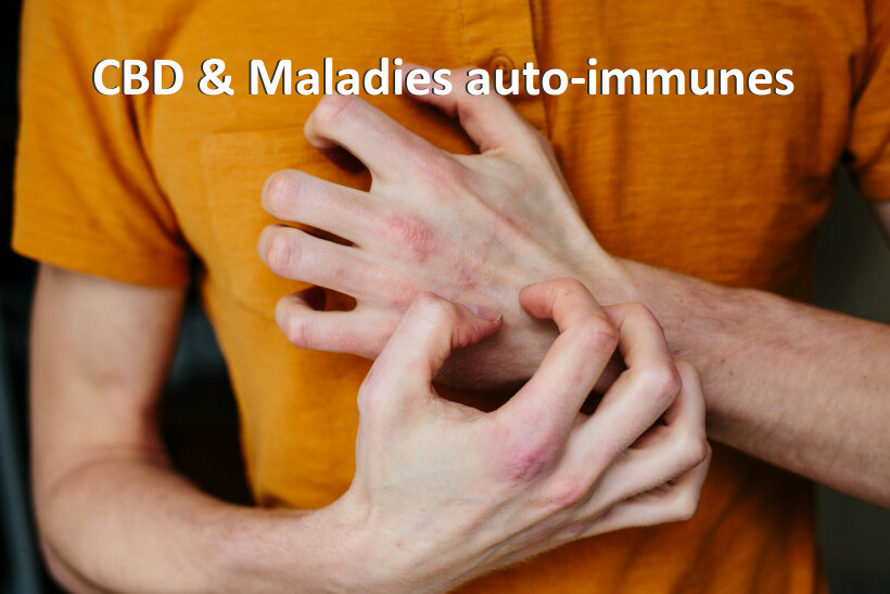 CBD & Maladies auto-immunes