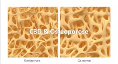 CBD et Ostéoporose