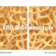 CBD et Ostéoporose