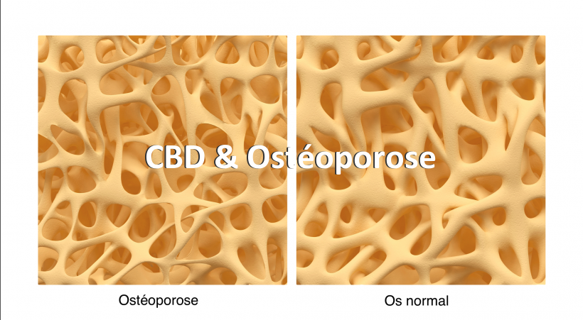 CBD & Ostéoporose