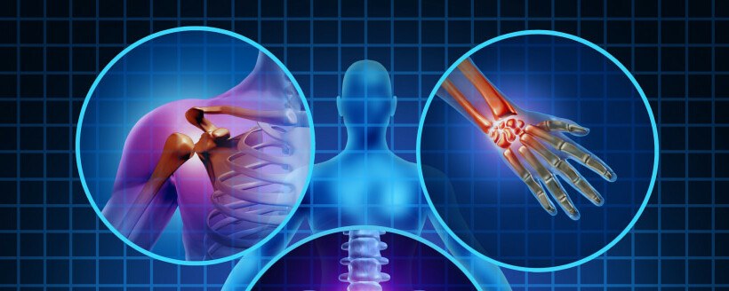 CBD y artritis