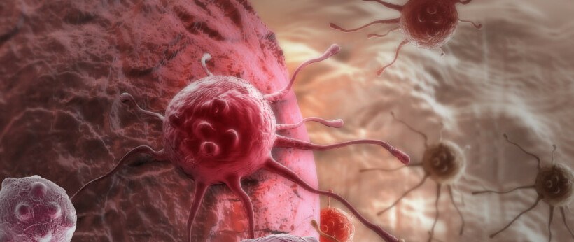 Cáncer y CBD